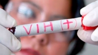 Yucat&aacute;n ocupa segundo lugar nacional con VIH-Sida