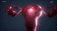 Despu&eacute;s de la menopausia se eleva el riesgo cardiovascular