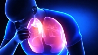 Tuberculosis, enfermedad infecciosa cr&oacute;nica m&aacute;s letal en el mundo