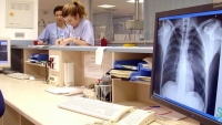 Tuberculosis, enfermedad antigua sin erradicarse