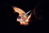 Confirman cerca de 40 mil casos de conjuntivitis en la Pen&iacute;nsula de Yucat&aacute;n