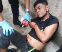 Atacan a hombre en Kanas&iacute;n